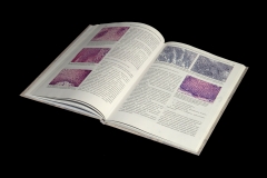 Книга «Атлас морфологической диагностики заболеваний пищевода»